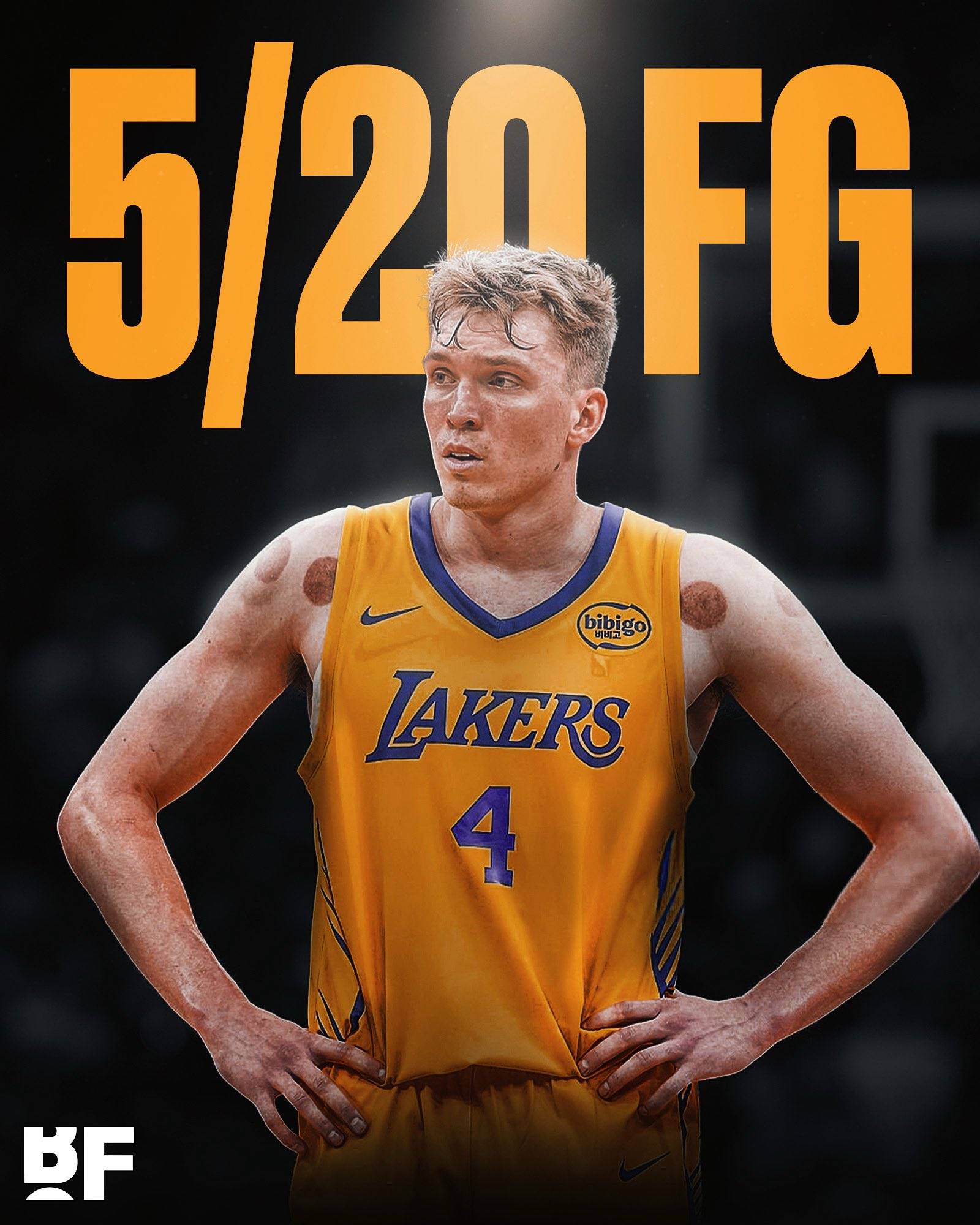 转会期洛杉矶湖人备战中超,绝杀压哨细节曝光,悬念犹存,年轻球员得到机会的简单介绍 转会期洛杉矶湖人备战中超,绝杀压哨细节曝光,悬念犹存,年轻球员得到机会的简单介绍